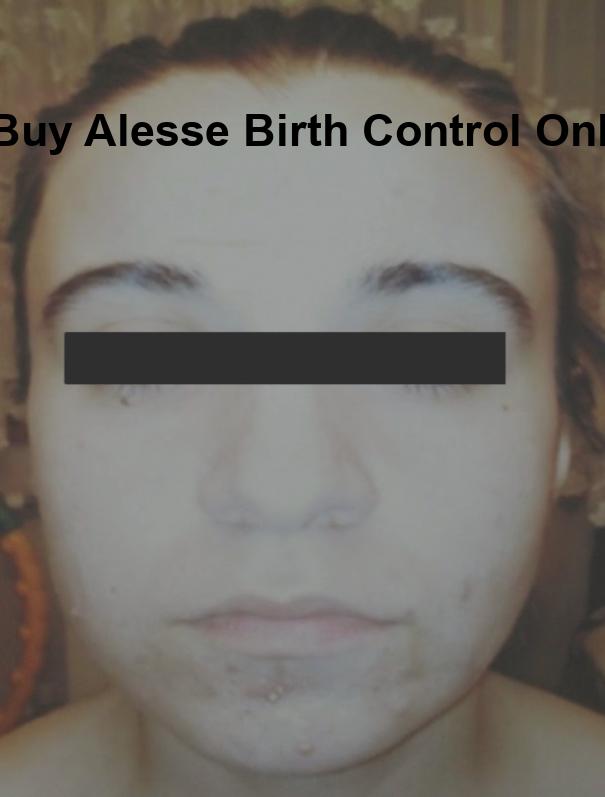 buy alesse birth control online